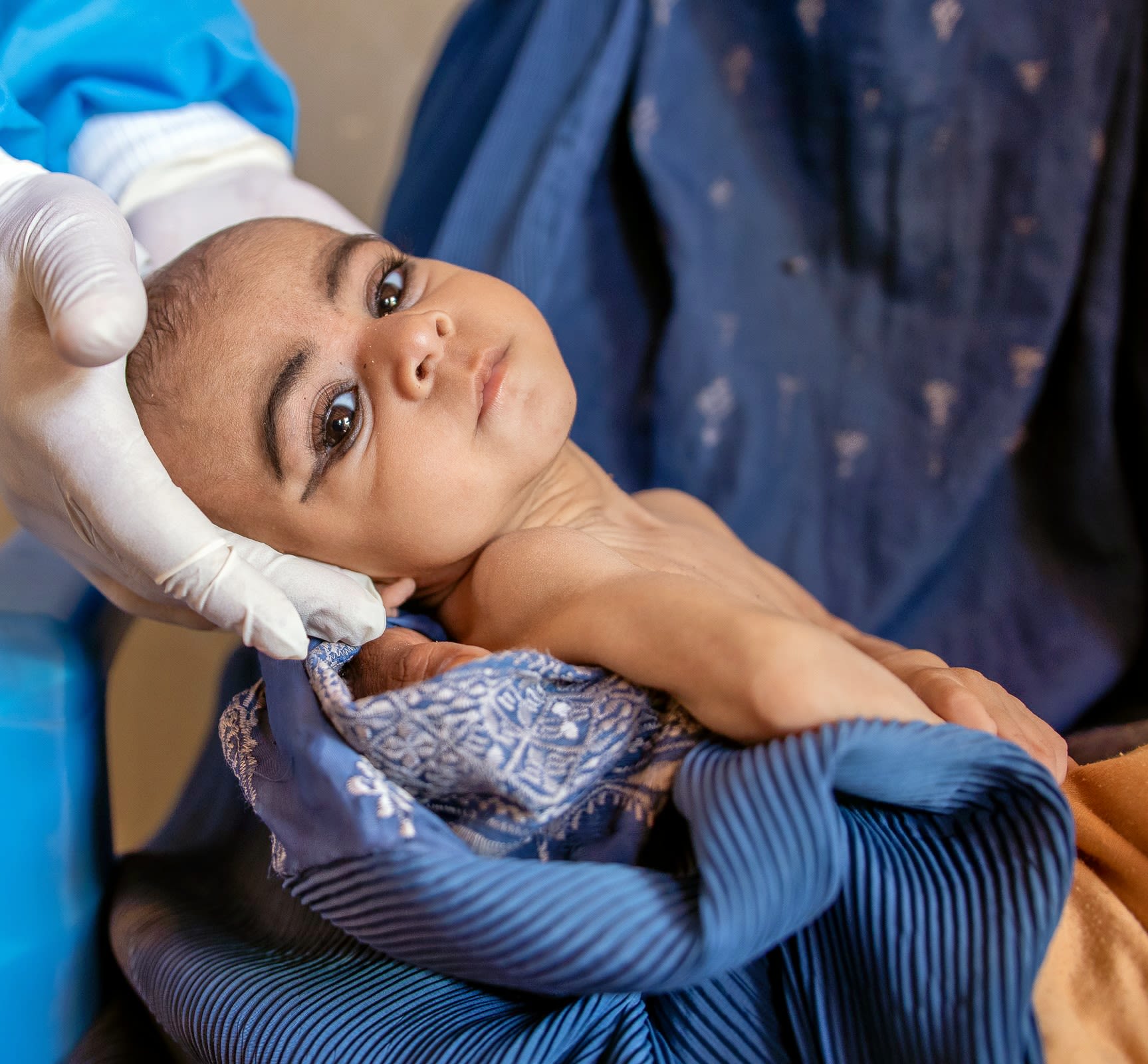 Temor's sister, Samera* (7 months), is receiving treatment for severe acute malnutrition at a Save the Children mobile clinic in Afghanistan
